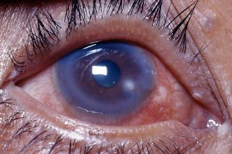 What should you do if you get coolant in your eyes?