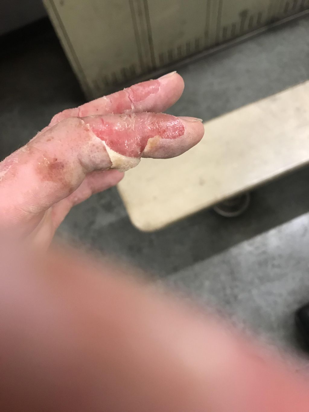 Is coolant safe on skin?